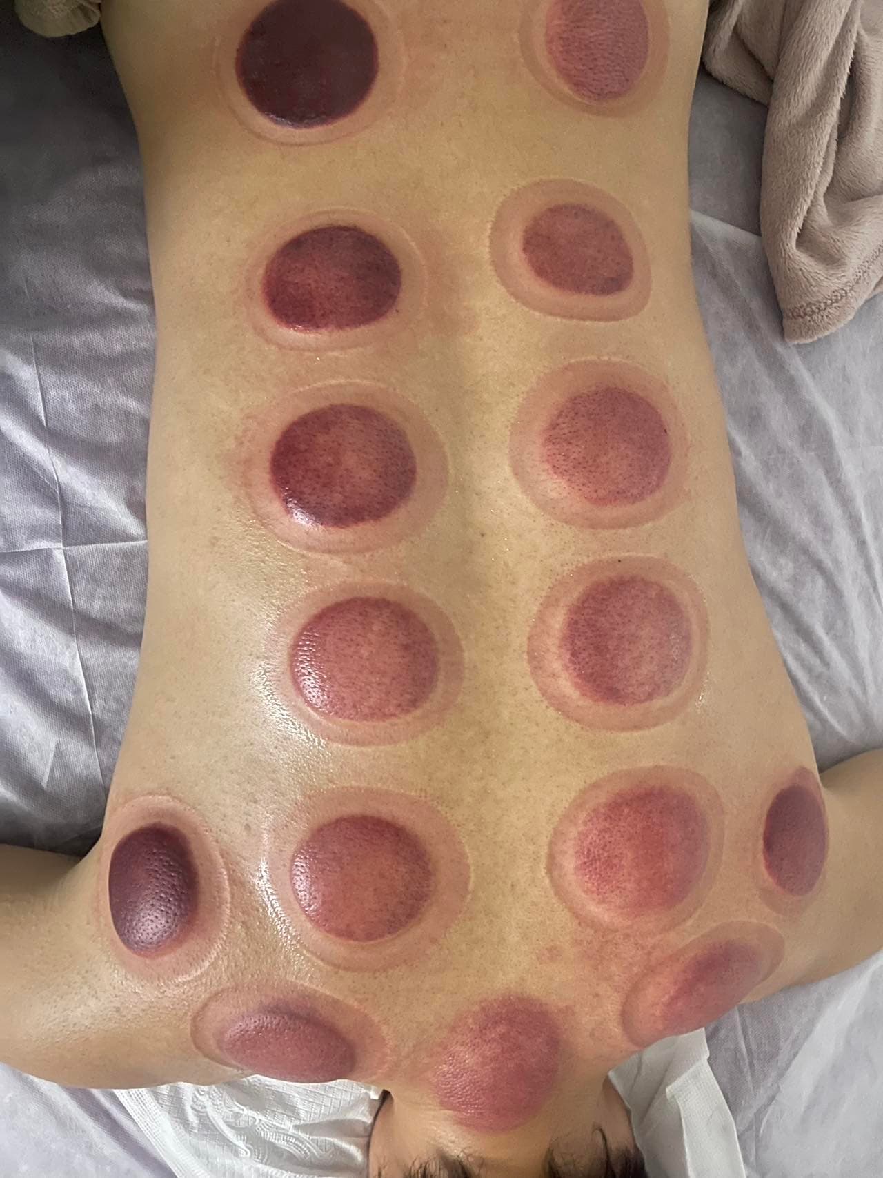 LMF Massage — Parramatta, Sydney