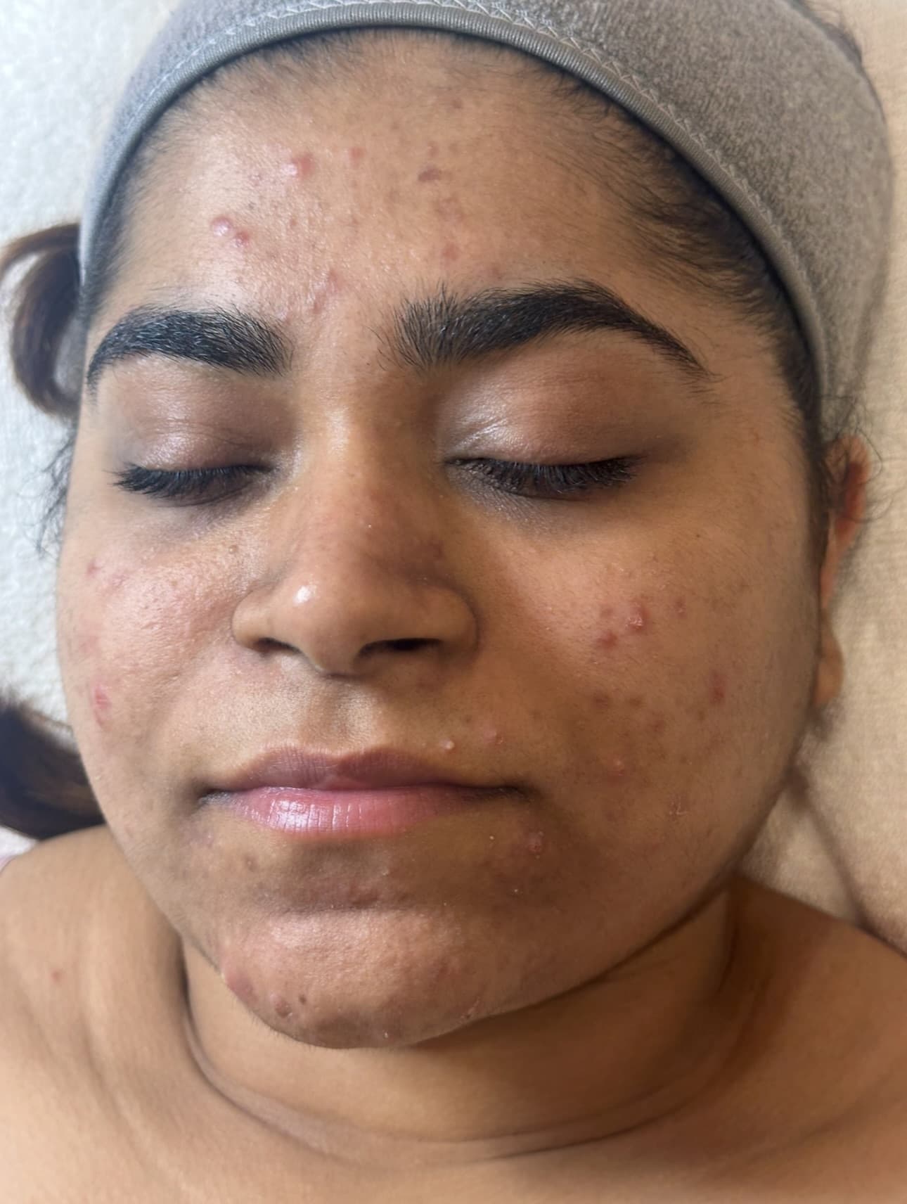 Beauty Medspa — Parramatta, Sydney